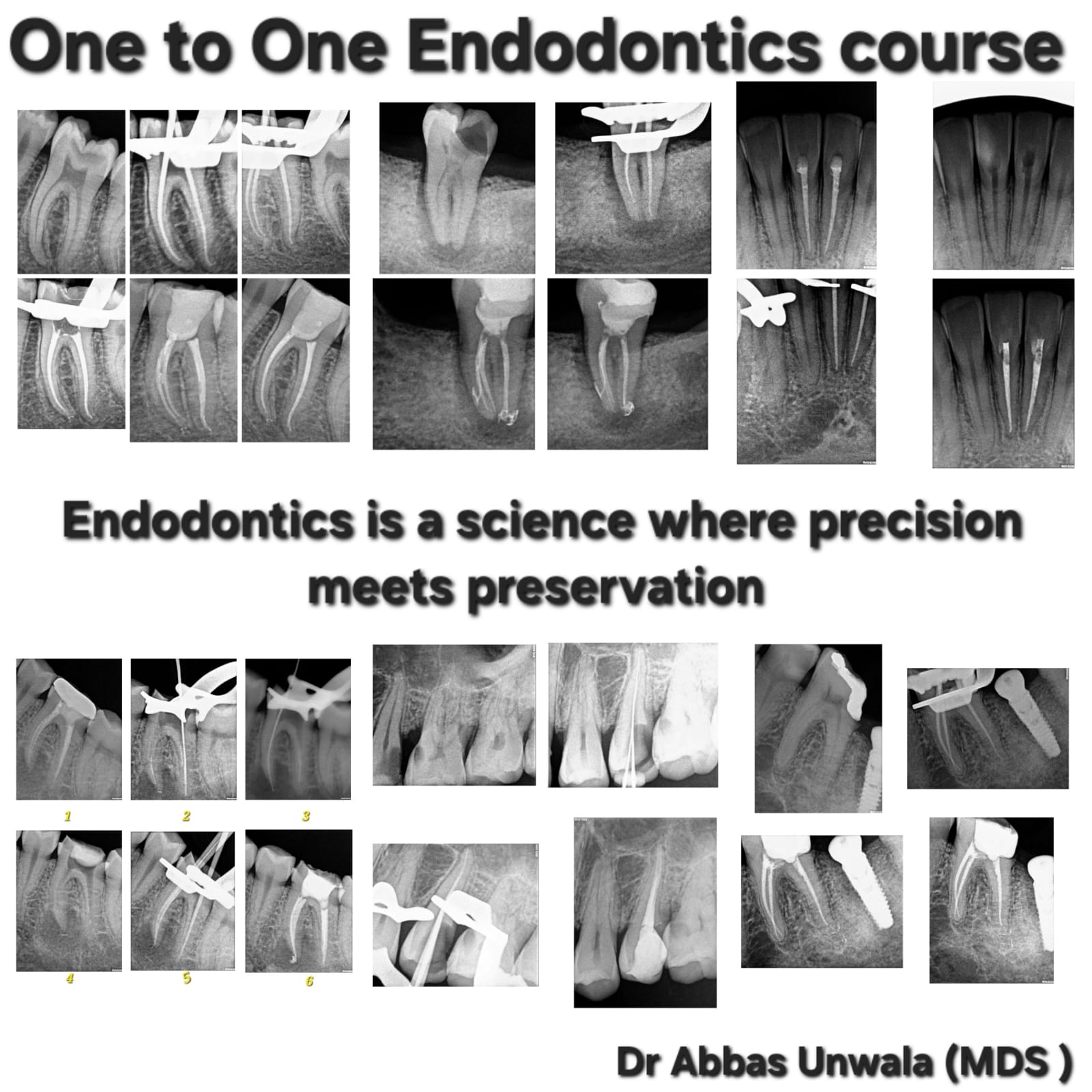 Dr. Abbas Unwala Endodontics Mentorship
