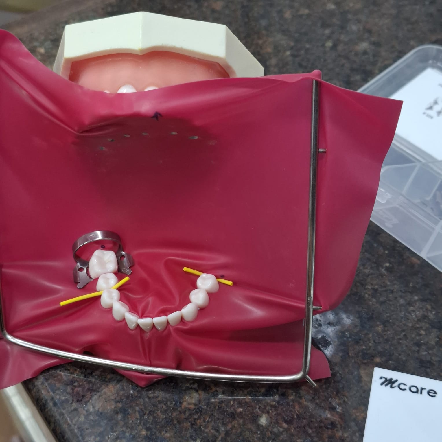 Rubber Dam Isolation Case 3