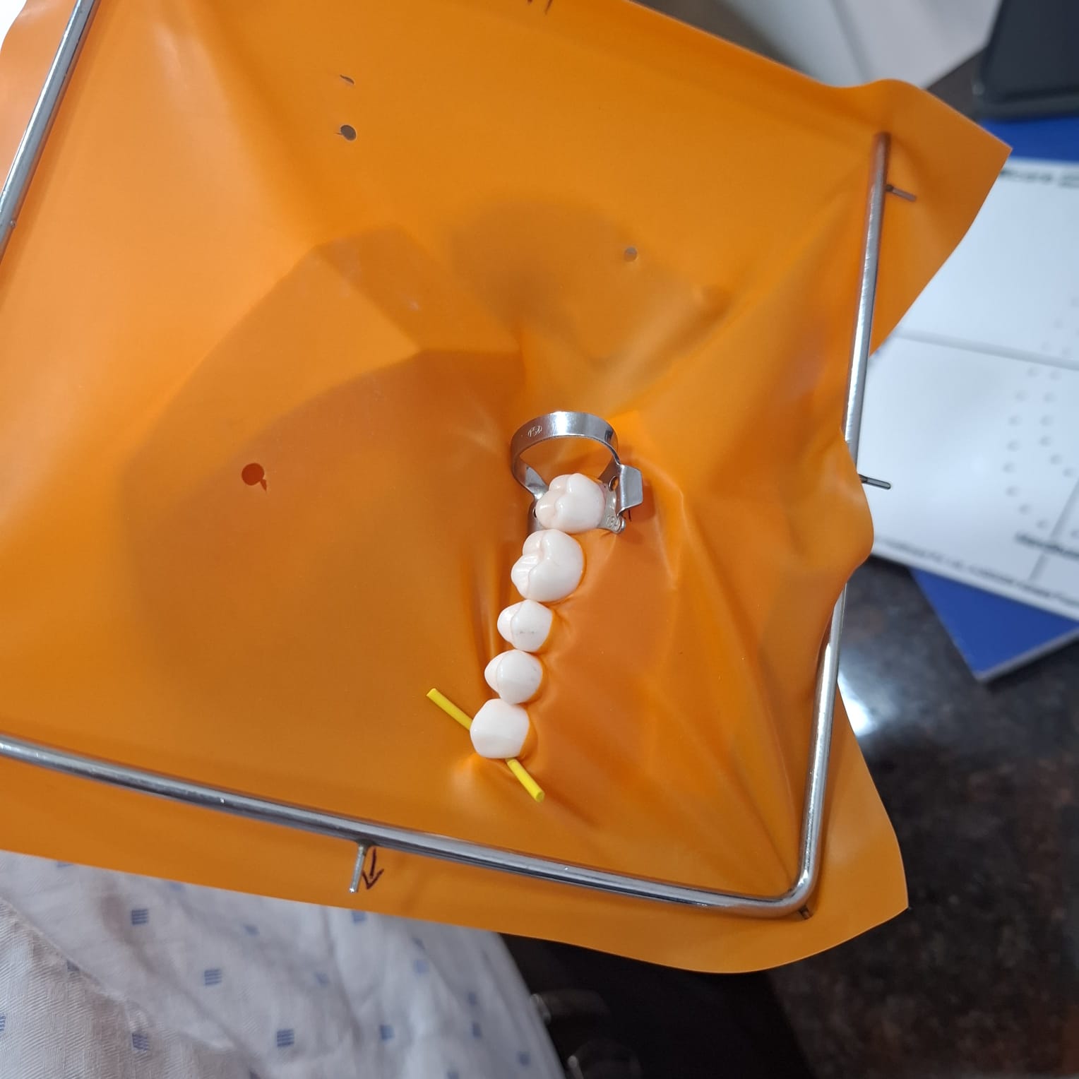 Rubber Dam Isolation Case 5